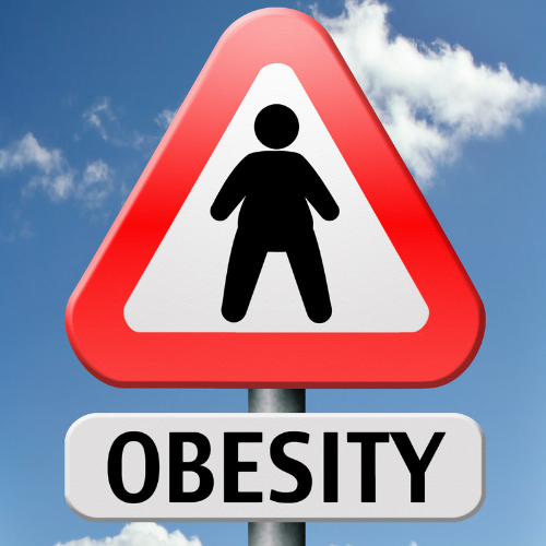 Fakta Unik Penyebab Obesitas (foto canva)